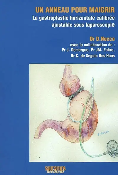 Un anneau pour maigrir : la gastroplastie horizontale calibrée ajustable sous laparoscopie