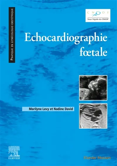 Echocardiographie foetale