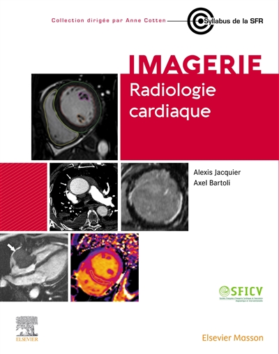 Radiologie cardiaque