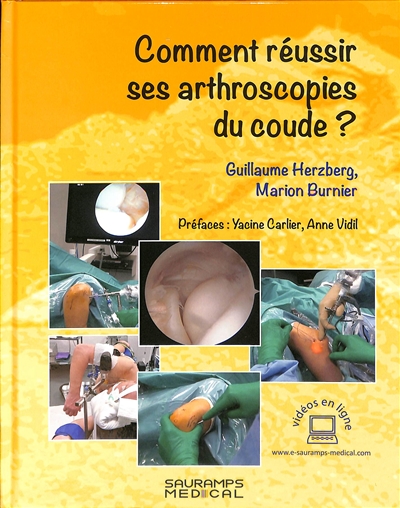 Comment réussir ses arthroscopies du coude ?