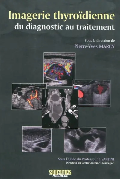 Imagerie thyroïdienne : du diagnostic au traitement