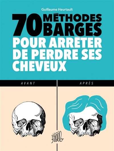 70 méthodes barges pour arrêter de perdre ses cheveux