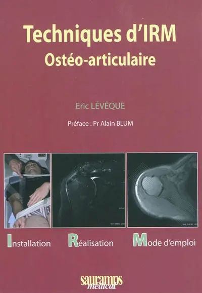 Techniques d'IRM ostéo-articulaire : installation, réalisation, mode d'emploi