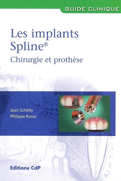 Les implants Spline : chirurgie et prothèse