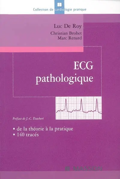 ECG pathologique : de la théorie à la pratique, 140 tracés