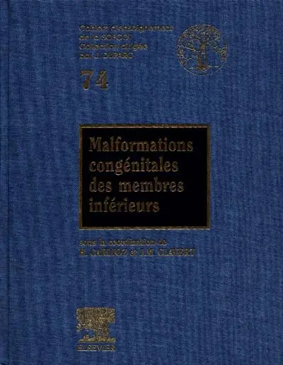 Malformations congénitales des membres inférieurs