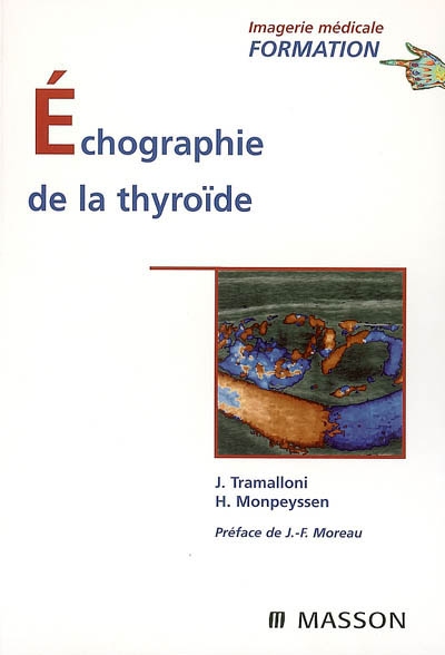Echographie de la thyroïde