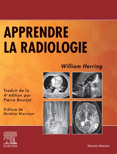 Apprendre la radiologie