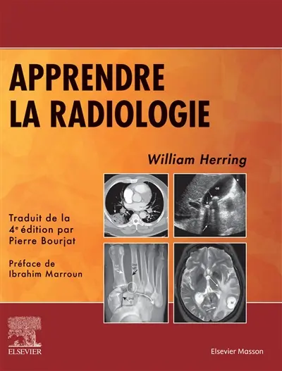 Apprendre la radiologie
