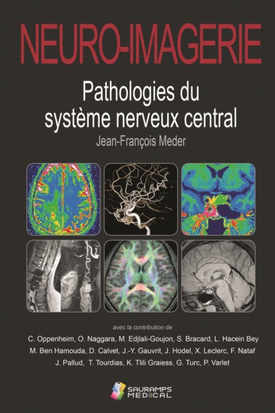 Neuro-imagerie : pathologies du système nerveux central