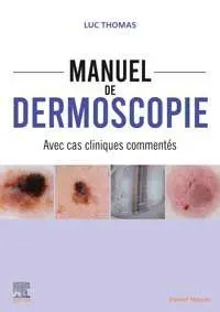 Manuel de dermoscopie : avec cas cliniques commentés