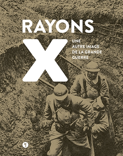 Rayons X : une autre image de la Grande Guerre