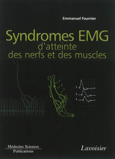 Electromyographie. Vol. 4. Syndromes EMG d'atteinte des nerfs et des muscles