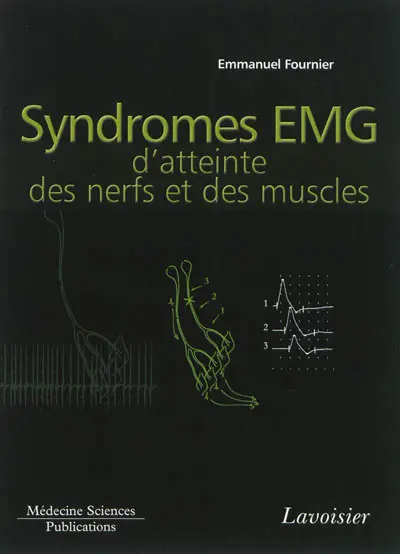 Electromyographie. Vol. 4. Syndromes EMG d'atteinte des nerfs et des muscles