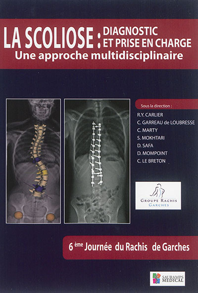 La scoliose : diagnostic et...