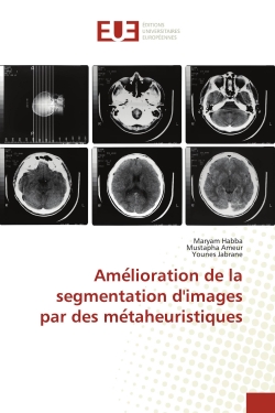 Ame lioration de la...