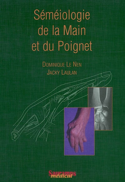 Séméiologie de la main et du poignet