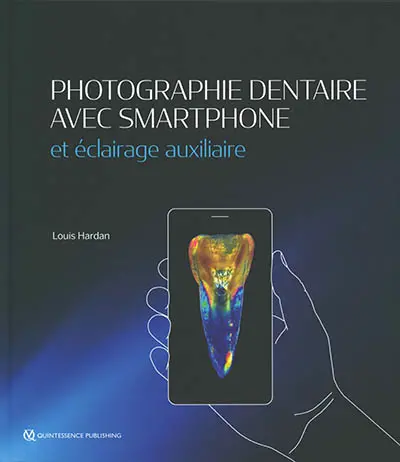 Photographie dentaire avec smartphone et éclairage auxiliaire Photographie dentaire avec smartphone et éclairage auxiliaire