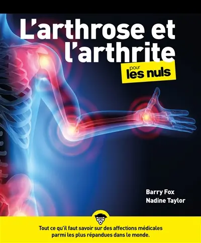 L'arthrose pour les nuls