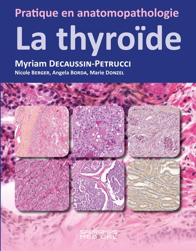 La thyroïde