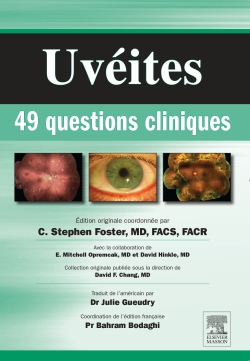 Uvéites : 49 questions cliniques