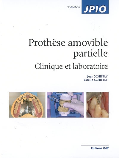 Prothèse amovible partielle : clinique et laboratoire