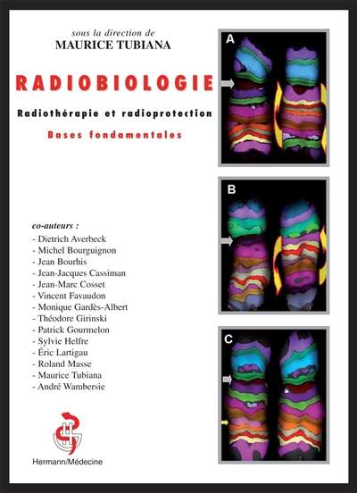 Radiobiologie : radiothérapie et radioprotection : bases fondamentales