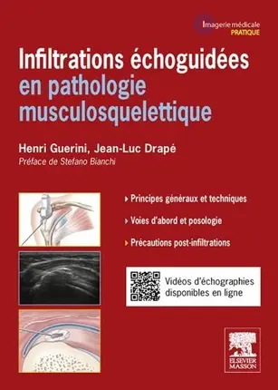 Infiltrations échoguidées : en pathologie musculosquelettique