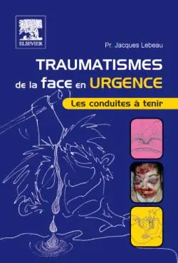 Traumatismes de la face en urgence : les conduites à tenir