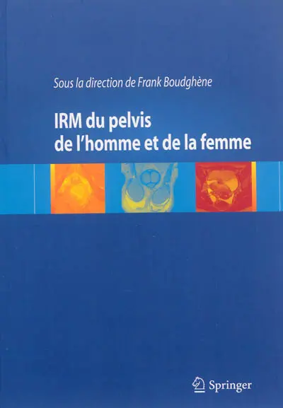 IRM du pelvis de l'homme et de la femme