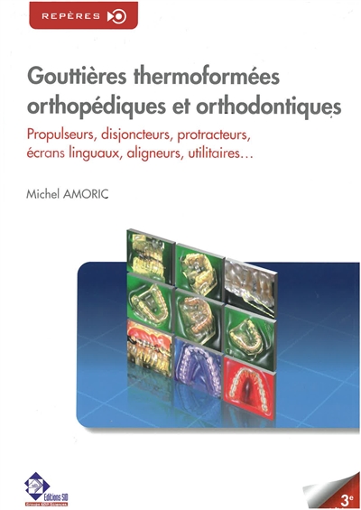 Gouttières thermoformées orthopédiques & orthodontiques