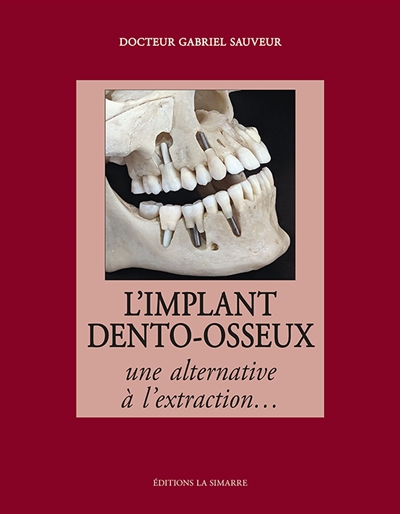 L'implant dento-osseux : une alternative à l'extraction...