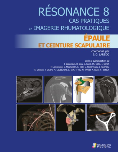 Résonance : diagnostic en imagerie rhumatologique. Vol. 8. Epaule et ceinture scapulaire