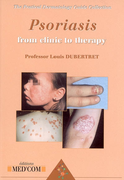 Psoriasis : from clinic to therapy