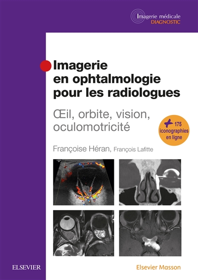 Imagerie en ophtalmologie pour les radiologues : oeil, orbite, vision, oculomotricité