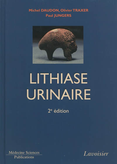 La lithiase urinaire