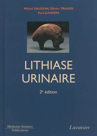 La lithiase urinaire