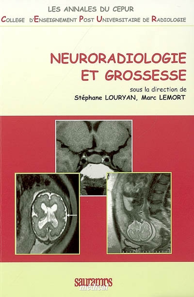 Neuroradiologie et grossesse
