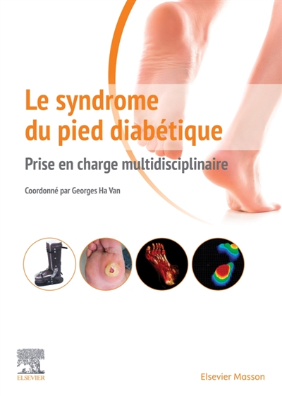 Le syndrome du pied...