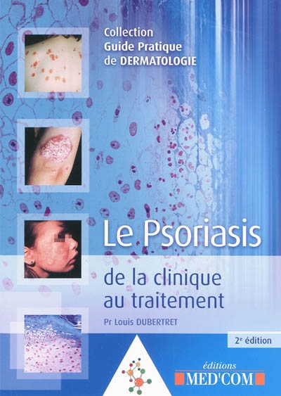 Le psoriasis : de la clinique au traitement
