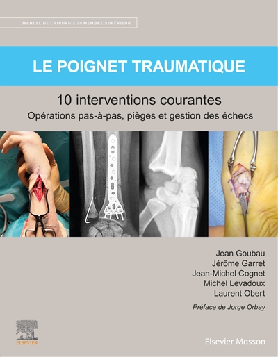 Le poignet traumatique : 10...