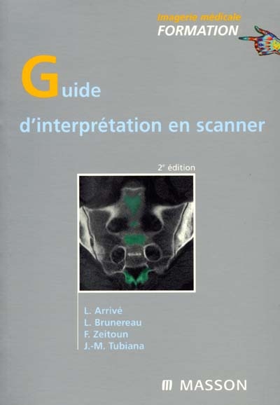 Guide d'interprétation en scanner