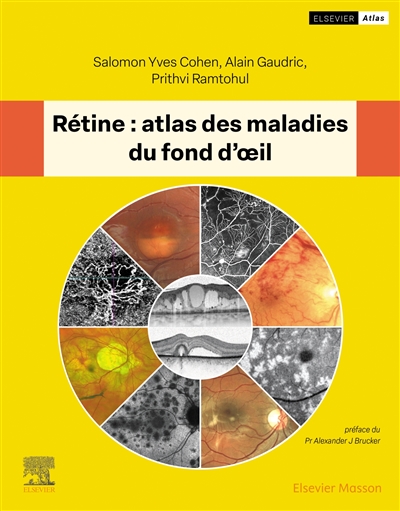 Rétine : atlas des maladies du fond d'oeil