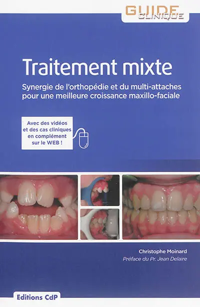 Traitement mixte : synergie de l'orthopédie et du multi-attaches pour une meilleure croissance maxillo-faciale