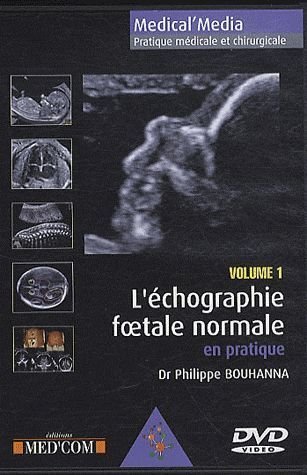 L'échographie foetale normale. Vol. 1