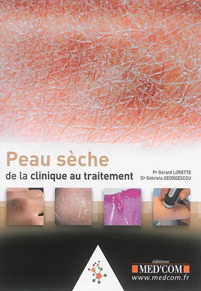Peau sèche : de la clinique au traitement