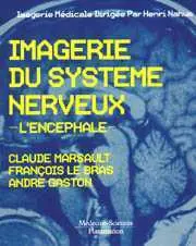 Imagerie du système nerveux : l'encéphale