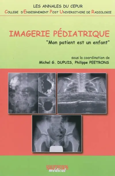 Imagerie pédiatrique : mon patient est un enfant