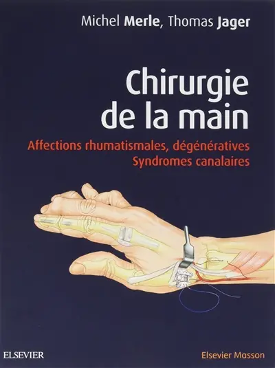 Chirurgie de la main
