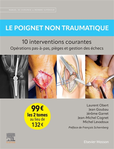 Pack Le poignet...